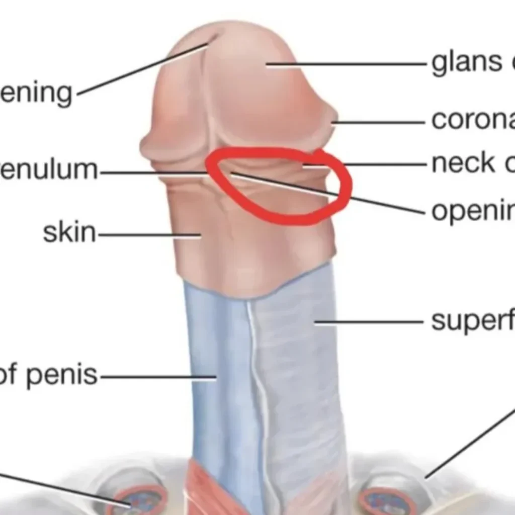 cara hilangkan ngilu di kepala zakar